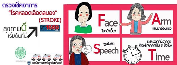 หลอดเลือดสมอง หลอดเลือดสมอง