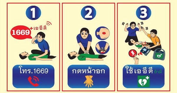 ช่วยชีวิตคนป่วยหัวใจหยุดเต้น ช่วยชีวิตคนป่วยหัวใจหยุดเต้น