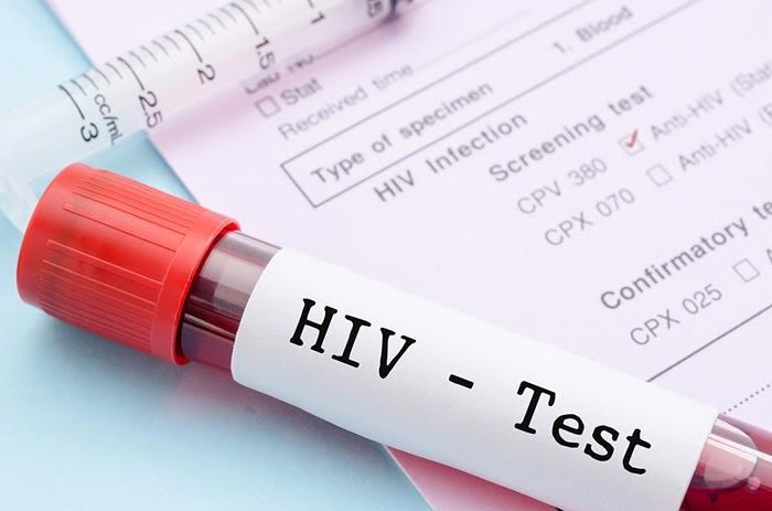 ตรวจhiv ตรวจhiv