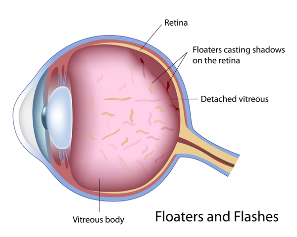Floater Floater
